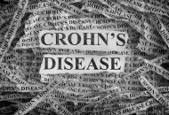 Why-You-Should-Consider-Getting-a-Medical-Marijuana-Card-for-Crohns-Disease